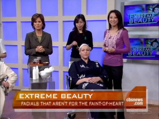 Extreme Facials on CBS's The Early Show include the Geisha "Bird Poop" Facial